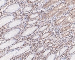 Invitrogen PP1 gamma Polyclonal Antibody 100 &mu;L; Unconjugated:Antibodies,