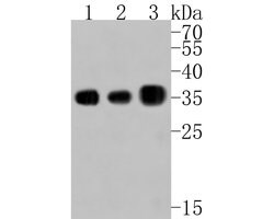 Invitrogen PP1 gamma Polyclonal Antibody 100 &mu;L; Unconjugated:Antibodies,