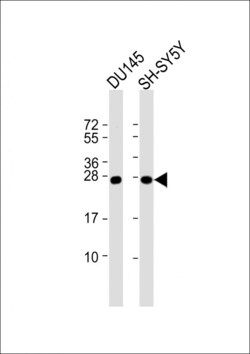 Invitrogen PGP9.5 Polyclonal Antibody 400 &mu;L; Unconjugated:Anticuerpos