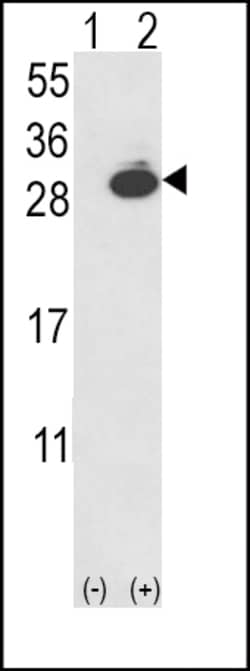 Invitrogen PGP9.5 Polyclonal Antibody 400 &mu;L; Unconjugated:Anticuerpos