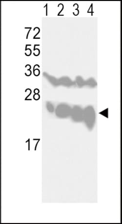 Invitrogen PGP9.5 Polyclonal Antibody 400 &mu;L; Unconjugated:Anticuerpos