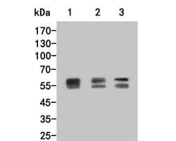 Invitrogen Lyn Polyclonal Antibody 100 &mu;L; Unconjugated:Antibodies,