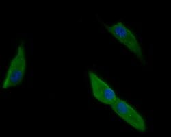 Invitrogen RGMA Polyclonal Antibody 100 &mu;L; Unconjugated:Antibodies,