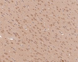 Invitrogen ASIC4 Polyclonal Antibody 100 &mu;L; Unconjugated:Antibodies,