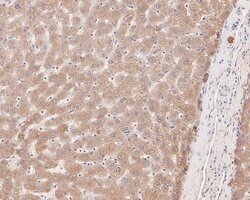 Invitrogen PRKCSH Polyclonal Antibody 100 &mu;L; Unconjugated:Antibodies,