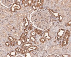 Invitrogen PRKCSH Polyclonal Antibody 100 &mu;L; Unconjugated:Antibodies,