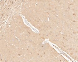 Invitrogen COX5B Polyclonal Antibody 100 &mu;L; Unconjugated:Antibodies,