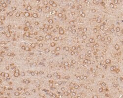 Invitrogen PPP1R9A Polyclonal Antibody 100 &mu;L; Unconjugated:Antibodies,