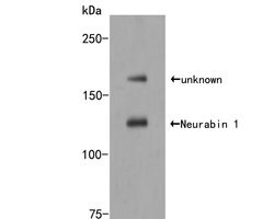 Invitrogen PPP1R9A Polyclonal Antibody 100 &mu;L; Unconjugated:Antibodies,