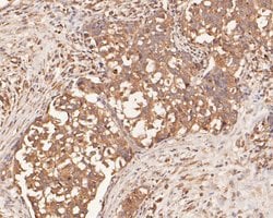 Invitrogen IL-32 Polyclonal Antibody 100 &mu;L; Unconjugated:Antibodies,