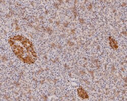 Invitrogen IL-32 Polyclonal Antibody 100 &mu;L; Unconjugated:Antibodies,