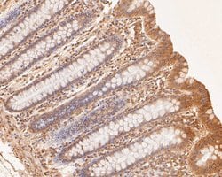 Invitrogen ZFHX3 Polyclonal Antibody 100 &mu;L; Unconjugated:Antibodies,