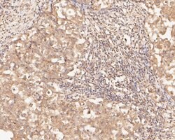 Invitrogen ZFHX3 Polyclonal Antibody 100 &mu;L; Unconjugated:Antibodies,