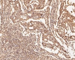 Invitrogen ZFHX3 Polyclonal Antibody 100 &mu;L; Unconjugated:Antibodies,