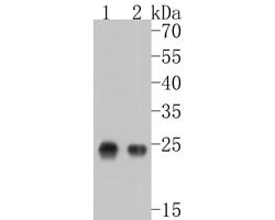 Invitrogen ZFHX3 Polyclonal Antibody 100 &mu;L; Unconjugated:Antibodies,