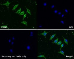 Invitrogen Trypsin 2 Polyclonal Antibody 100 &mu;L; Unconjugated:Antibodies,