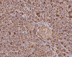 Invitrogen Trypsin 2 Polyclonal Antibody 100 &mu;L; Unconjugated:Antibodies,