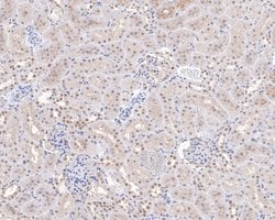Invitrogen TAF1 Polyclonal Antibody 100 &mu;L; Unconjugated:Antibodies,