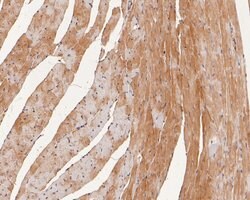 Invitrogen CTNNA3 Polyclonal Antibody 100 &mu;L; Unconjugated:Antibodies,
