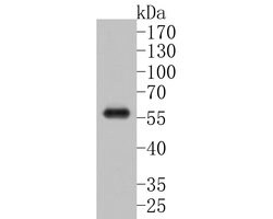Invitrogen CTNNA3 Polyclonal Antibody 100 &mu;L; Unconjugated:Antibodies,