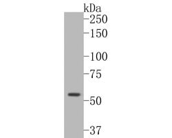 Invitrogen CTNNA3 Polyclonal Antibody 100 &mu;L; Unconjugated:Antibodies,