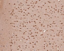 Invitrogen ZIC2 Polyclonal Antibody 100 &mu;L | Buy Online | Invitrogen&trade; | Fisher Scientific