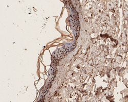 Invitrogen ZIC2 Polyclonal Antibody 100 &mu;L | Buy Online | Invitrogen&trade; | Fisher Scientific