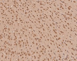 Invitrogen ZIC2 Polyclonal Antibody 100 &mu;L | Buy Online | Invitrogen&trade; | Fisher Scientific