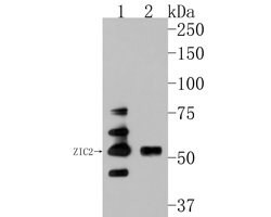 Invitrogen ZIC2 Polyclonal Antibody 100 &mu;L | Buy Online | Invitrogen&trade; | Fisher Scientific