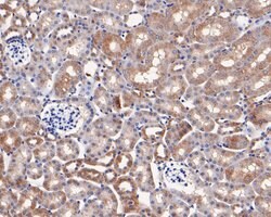 Invitrogen CYP24A1 Polyclonal Antibody 100 &mu;L; Unconjugated:Antibodies,