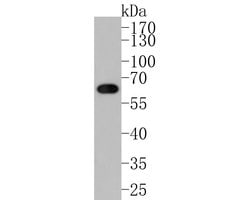 Invitrogen CYP24A1 Polyclonal Antibody 100 &mu;L; Unconjugated:Antibodies,