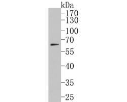 Invitrogen CYP24A1 Polyclonal Antibody 100 &mu;L; Unconjugated:Antibodies,