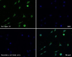 Invitrogen Collagen IV Polyclonal Antibody 100 &mu;L; Unconjugated:Antibodies,
