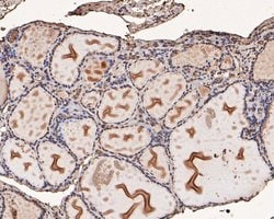 Invitrogen PFKFB2 Polyclonal Antibody 100 &mu;L; Unconjugated:Antibodies,
