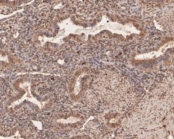Invitrogen PFKFB2 Polyclonal Antibody 100 &mu;L; Unconjugated:Antibodies,