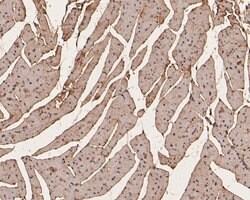 Invitrogen PFKFB2 Polyclonal Antibody 100 &mu;L; Unconjugated:Antibodies,
