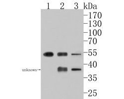 Invitrogen PFKFB2 Polyclonal Antibody 100 &mu;L; Unconjugated:Antibodies,