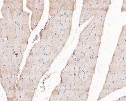 Invitrogen PIP5K1A Polyclonal Antibody 100 &mu;L; Unconjugated:Antibodies,