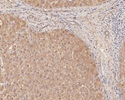 Invitrogen PIP5K1A Polyclonal Antibody 100 &mu;L; Unconjugated:Antibodies,
