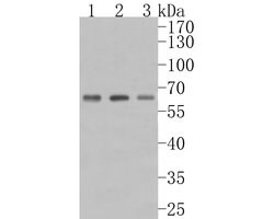 Invitrogen PIP5K1A Polyclonal Antibody 100 &mu;L; Unconjugated:Antibodies,