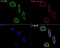 Invitrogen CYP7A1 Polyclonal Antibody 100 μL; Unconjugated:Antibodies,