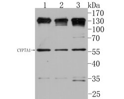 Invitrogen CYP7A1 Polyclonal Antibody 100 μL; Unconjugated:Antibodies,