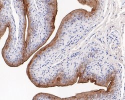 Invitrogen Uroplakin III Polyclonal Antibody 100 &mu;L; Unconjugated:Antibodies,