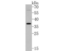 Invitrogen Uroplakin III Polyclonal Antibody 100 &mu;L; Unconjugated:Antibodies,