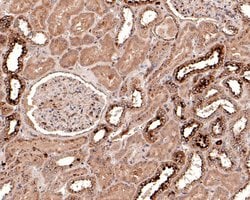 Invitrogen KCNK6 Polyclonal Antibody 100 &mu;L; Unconjugated:Antibodies,