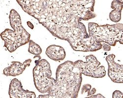 Invitrogen KCNK6 Polyclonal Antibody 100 &mu;L; Unconjugated:Antibodies,