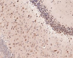 Invitrogen KCNK6 Polyclonal Antibody 100 &mu;L; Unconjugated:Antibodies,