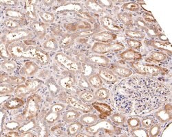 Invitrogen CLCNKB Polyclonal Antibody 100 μL; Unconjugated:Antibodies,