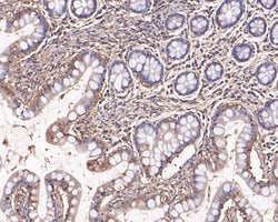 Invitrogen Presenilin 1 Polyclonal Antibody 100 &mu;L; Unconjugated:Antibodies,