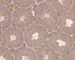 Invitrogen Presenilin 1 Polyclonal Antibody 100 &mu;L; Unconjugated:Antibodies,